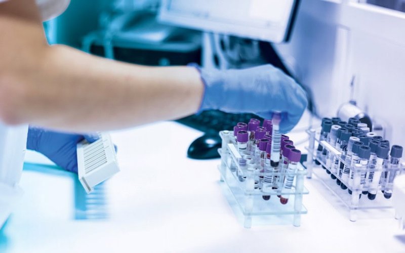 Rhythm Biosciences’ 2G ColoSTAT colorectal cancer detection kit outperforms predecessor in key testing