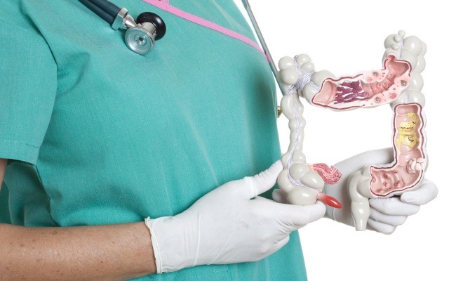 Rhythm Biosciences advances development of novel colorectal cancer test