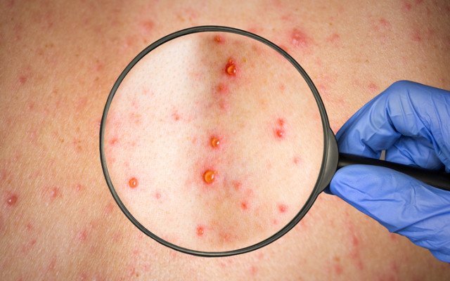 Shareholders desert Phosphagenics after unsuccessful arbitration ruling